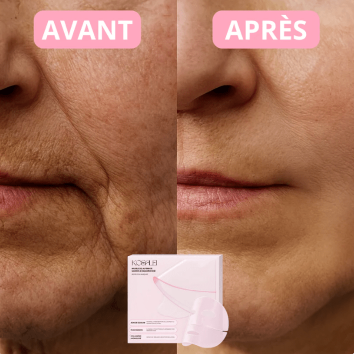 Patchs Yeux Instant Lift PDRN & Collagène - Celederm