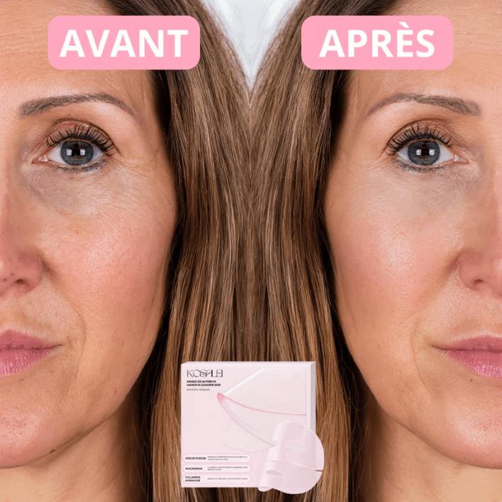 Patchs Yeux Instant Lift PDRN & Collagène - Celederm