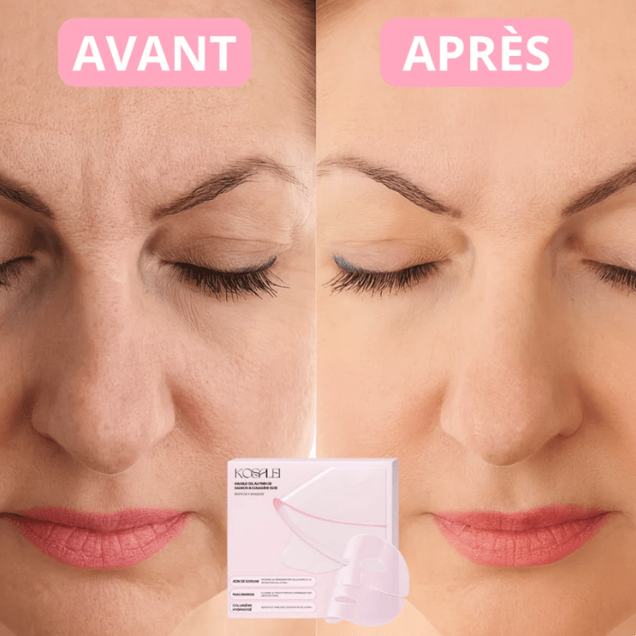 Patchs Yeux Instant Lift PDRN & Collagène - Celederm