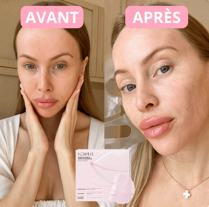 Patchs Yeux Instant Lift PDRN & Collagène - Celederm