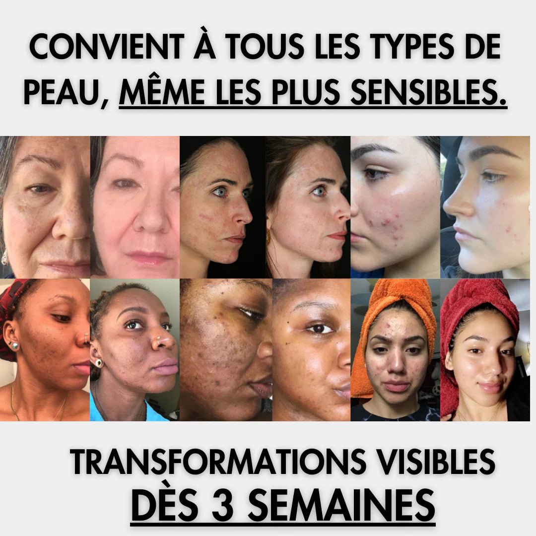 Patchs Yeux Instant Lift PDRN & Collagène - Celederm