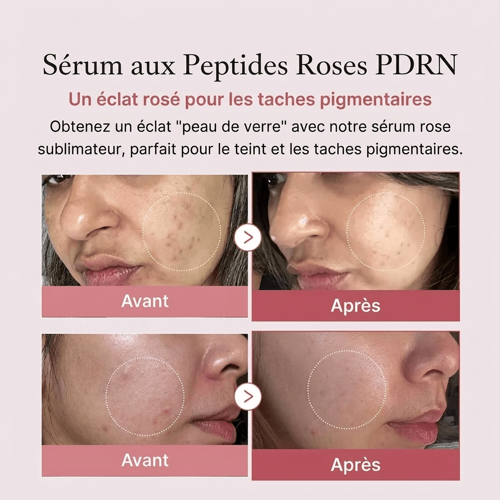 Patchs Yeux Instant Lift PDRN & Collagène - Celederm