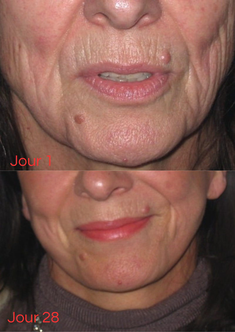 Ma peau a 10 ans de moins